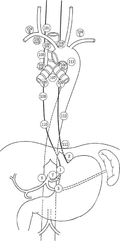 Naming Of Regional Lymph Nodes By The Japanese Society For Esophageal