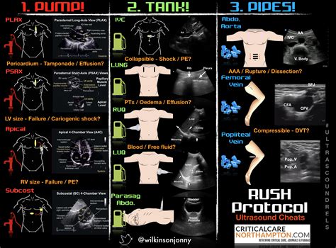 Rush Protocol Rapid Ultrasound For Shock And Hypotension Infographic