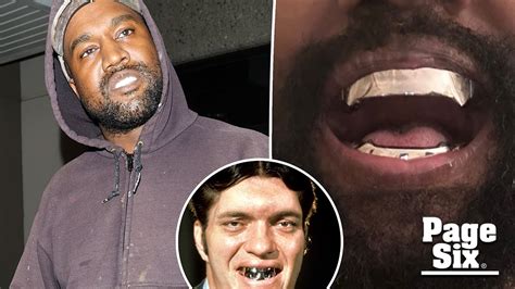 Kanye West Gets 850k Titanium Dentures Modeled After James Bond Spy