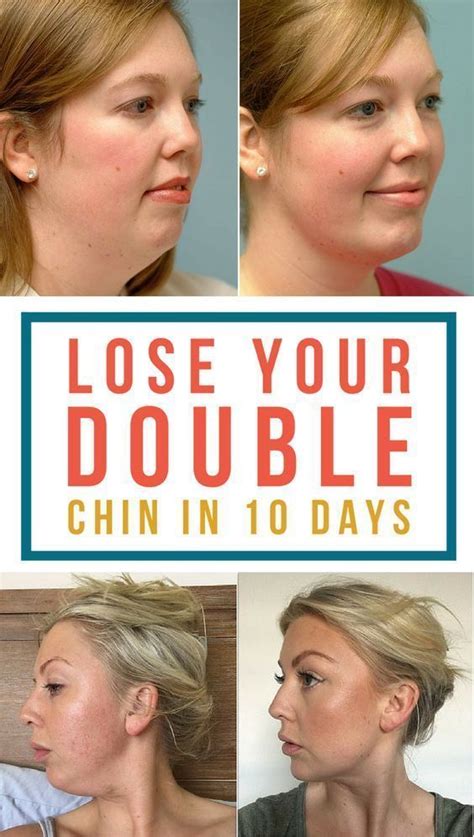 How To Lose Double Chin In 10 Days Best Way Double Chin Exercises
