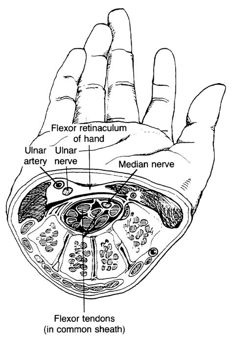 Entrapment Neuropathies Of The Upper Extremities Nejm