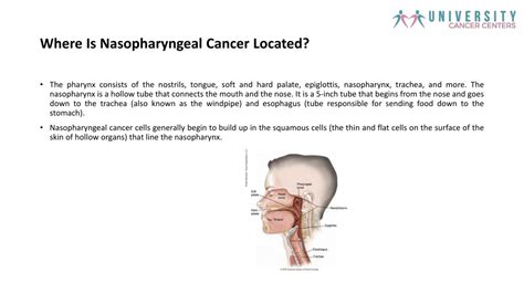 Ppt What Is Nasopharyngeal Cancer Causes Symptoms And Treatment