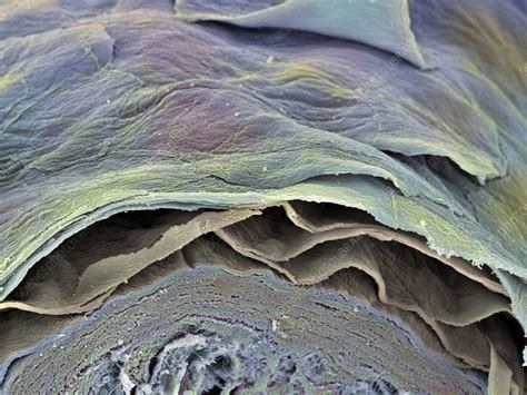 Skin Layers Sem Stock Image P7100356 Science Photo Library