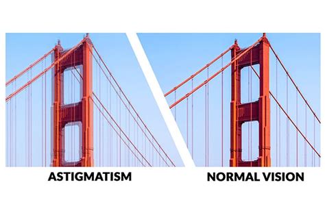 Common Types Of Astigmatism All About Vision