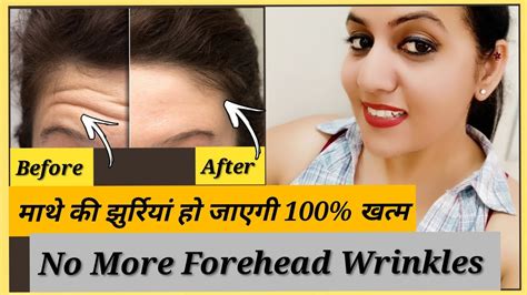 How To Remove Forehead Wrinkles Stress And Frown Lines Naturally At Home By Face Yoga Exercise
