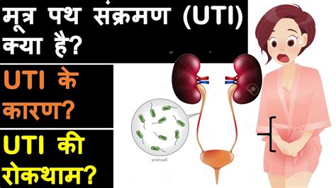 Urinary Tract Infection Uti Overview Symptoms Causes And Prevention Hindi Priyank