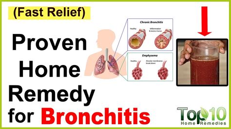 A Quick Home Remedy For Bronchitis Youtube