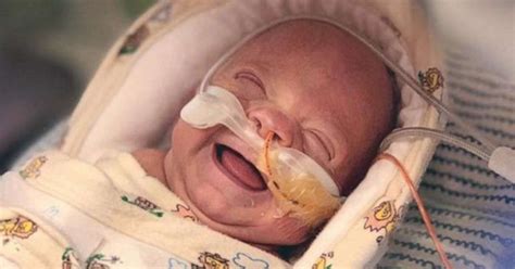 1 Pound Micro Preemie Who Fought 100 Days In Nicu Heads Home After
