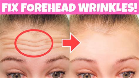 Reduce Forehead Wrinkles In 2 Weeks Forehead Massageand Exercise Get