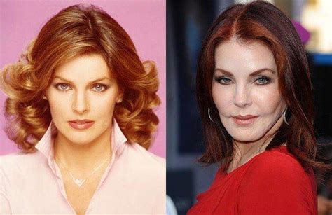 10 Before And After Celebrity Plastic Surgery Fails That