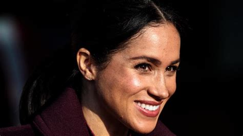 Meghan Markle Women Request Nose Freckle Treatment To Look Like Royal