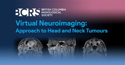 Virtual Neuroimaging Approach To Head And Neck Tumours British