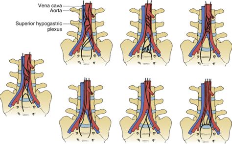 Lumbar And Sacral Spine Neupsy Key
