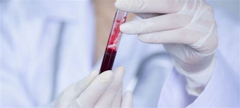 Blood Cancer Research Finds New Treatment Approach