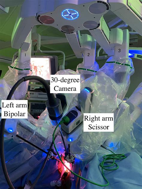 Robot Assisted Transvaginal Natural Orifice Transluminal Endoscopic