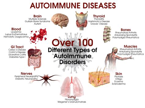 Infectious Auto Immune Diseases Often Cause Nerve Damage Neuropathy