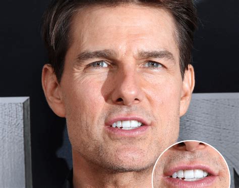 Tom Cruises Middle Tooth — The Story Behind His Smile