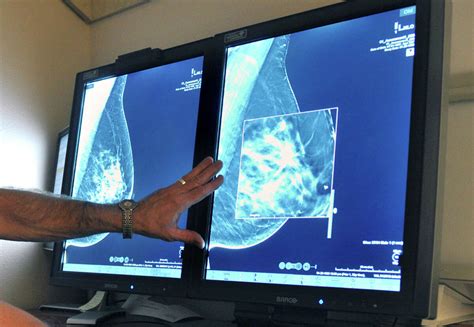 Study Questions Value Of Mammograms Breast Cancer Screening