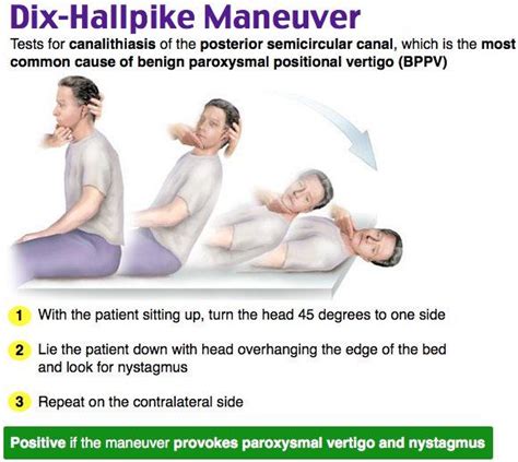 Dix Hallpike Maneuver Medical Mnemonics Medical Nursing Tips