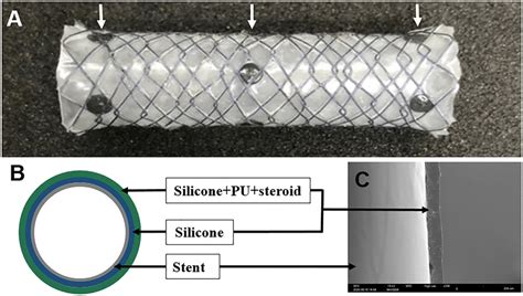 Fully Covered Self Expanding Metal Stent With A Download
