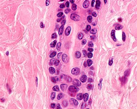 Sweat Gland Intradermal Duct Stock Photo Image Of Dermis Human