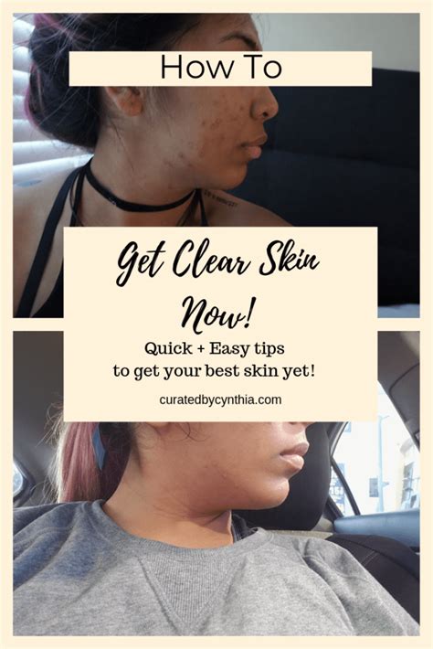 Skin Care 101 How To Get Clear Skin Fast Curated By Cynthia Clear
