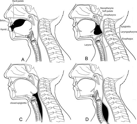 Surgical Anatomy And Physiology Of Swallowing Operative Techniques In