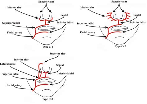 A Detailed Observation Of Variations Of The Facial Artery With