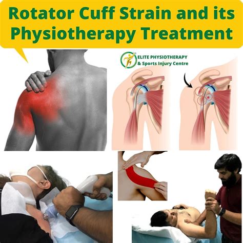 Rotator Cuff Strain And Its Physiotherapy Treatment Elite Physio