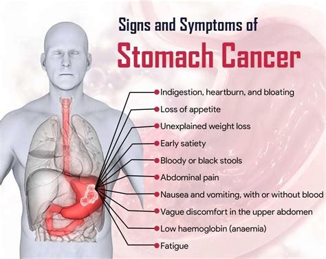 Stomach Cancer Treatment And Surgery Dr Nikhil Agrawal Best Gi