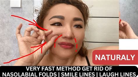 Very Fast Method Get Rid Of Nasolabial Folds Smile Lines Laugh