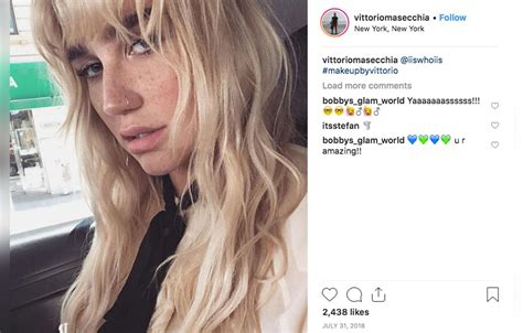 Kesha Shows Off Her Freckles In Gorgeous Makeup Free Selfie