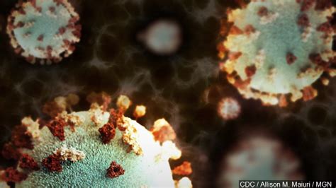 Two People In Utah Infected With Mumps One More Infected With Measles