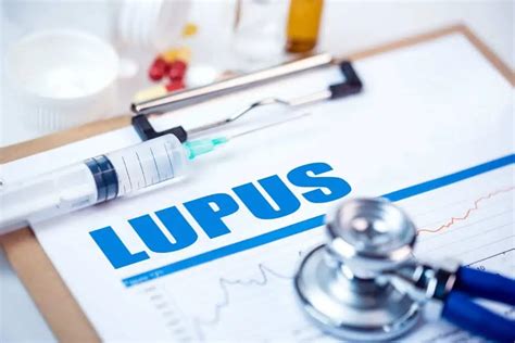 Sistemski Eritemski Lupus Uzrok Simptomi Liječenje Arzhr