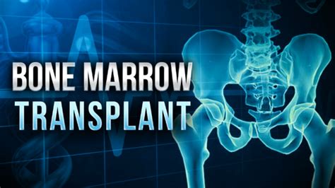 Bone Marrow Bone Marrow Transplantation Pictures
