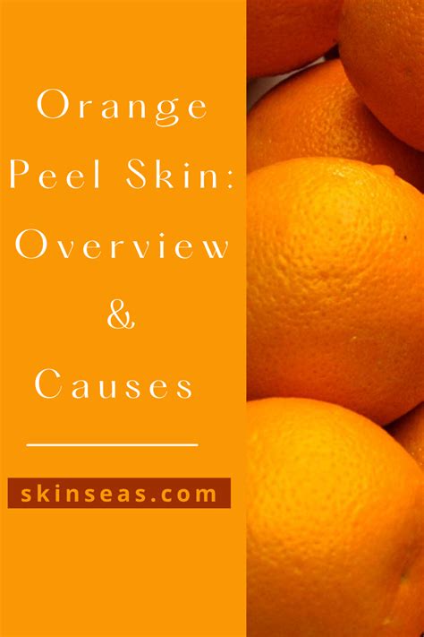 How To Get Rid Of Orange Peel Skin Texture In 2021 Orange Peel Skin