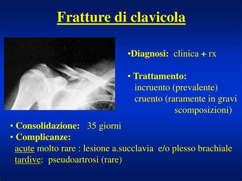 PPT - Fratture dell'arto superiore PowerPoint Presentation ...