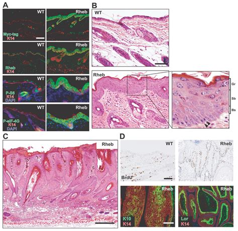 Rheb Induced MTORC1 Hyperactivation And Produced Epidermal Neoplasia