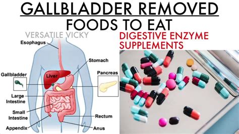 Diet After Removal Of Gallbladder
