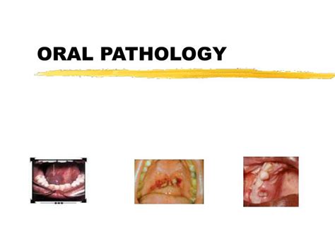 Ppt Oral Pathology Powerpoint Presentation Free Download Id5755148