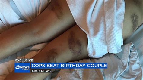 couple suing city of san jose police over use of force in hotel altercation abc news