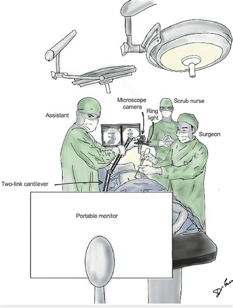 Graphical Illustration Of The Operating Room Setup During The