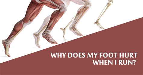 Why Does My Foot Hurt When I Run Runners Connect