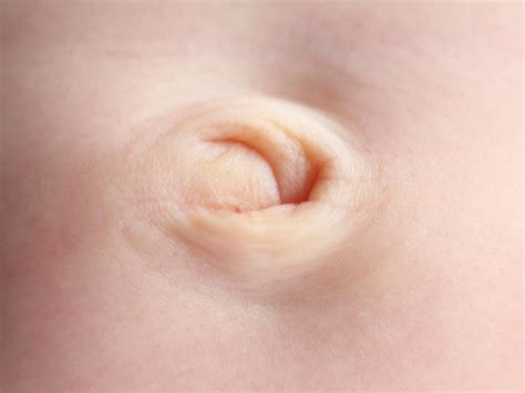 Is It True That You Can Change A Baby S Belly Button From An Outie To An Innie Babycenter