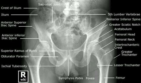 Pelvis male diagram anatomy ray pelvic muscles which anatomynote seen reproductive organs physiology houses own. 17 Best images about My Dream Job: Radiography on ...