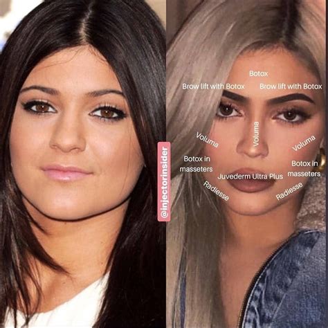 Best Of Cosmetic Dermatology On Instagram This Is How Would We