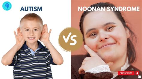 Pin By Kaley Smith On Noonan Syndrome Noonan Syndrome Noonan Syndrome