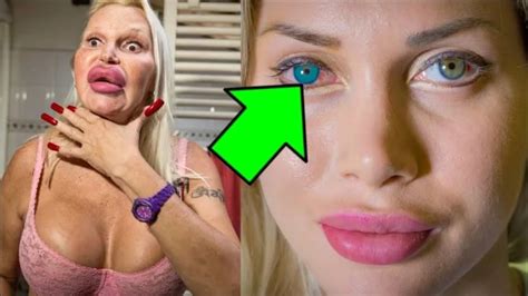 10 People With Extreme Plastic Surgery Addiction Youtube
