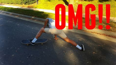 Kid Breaks His Leg While Skateboarding Youtube