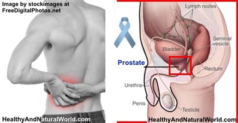 Care guide for liver cancer. Prostate Cancer - Warning Signs and Symptoms You Shouldn't ...